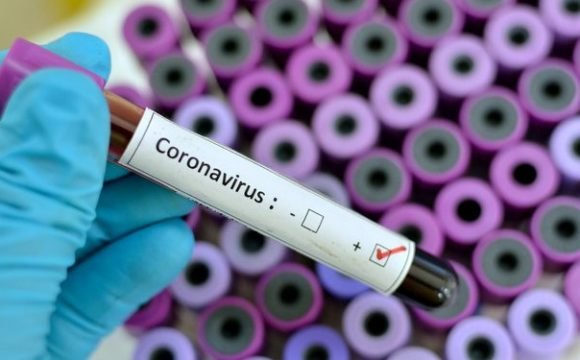 Ghana’s Coronavirus case count rises to 132
